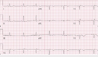 ECG Test Pune Shivajinagar Affordable