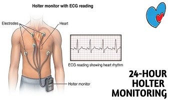 24 Hr Holter monitoring in Pune Shivajinagar