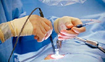 Cardiac Surgery/open heart surgery in Pune